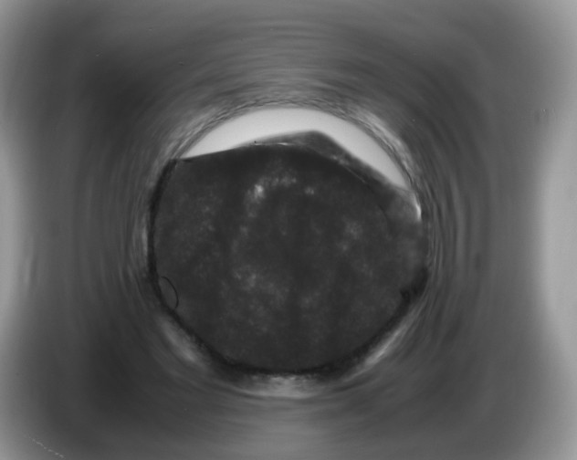 X0000086260493200704261959