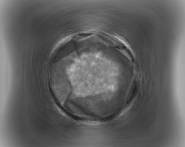 X0000086260577200704261957