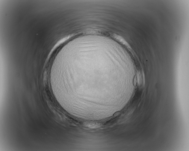 X0000086260579200704261957