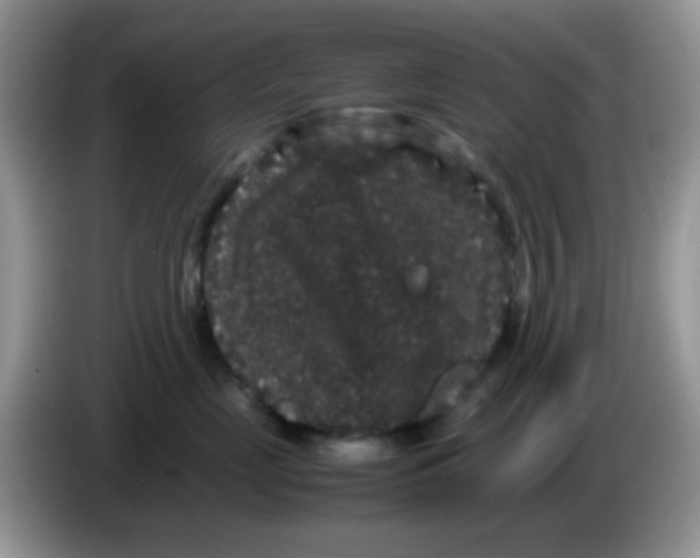 X0000086260669200704261957