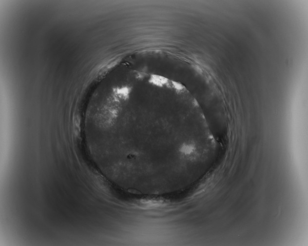 X0000086260693200704261956