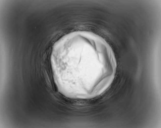 X0000086260749200704261955