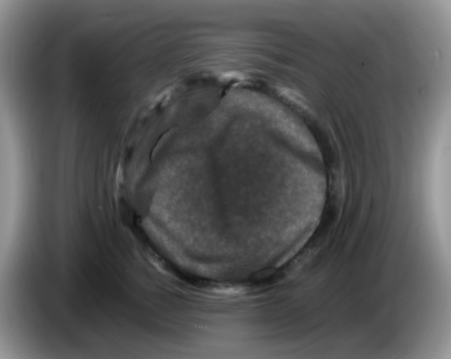 X0000086260760200704261955