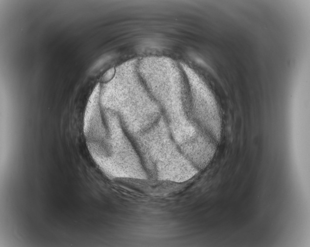 X0000086260870200704261954