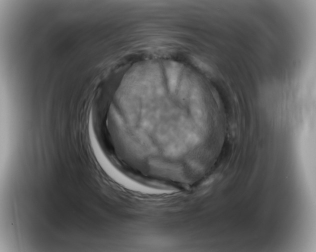 X0000086261010200704261951