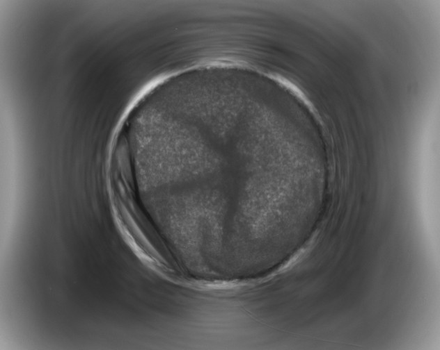 X0000086261038200704261952