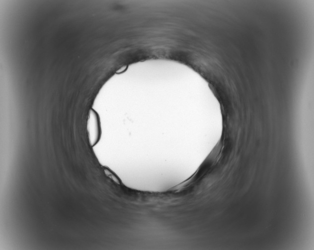 X0000086261057200704261951