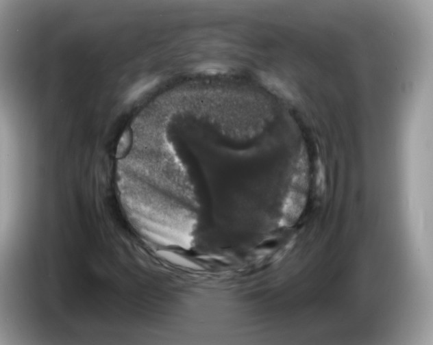 X0000086261158200704261950