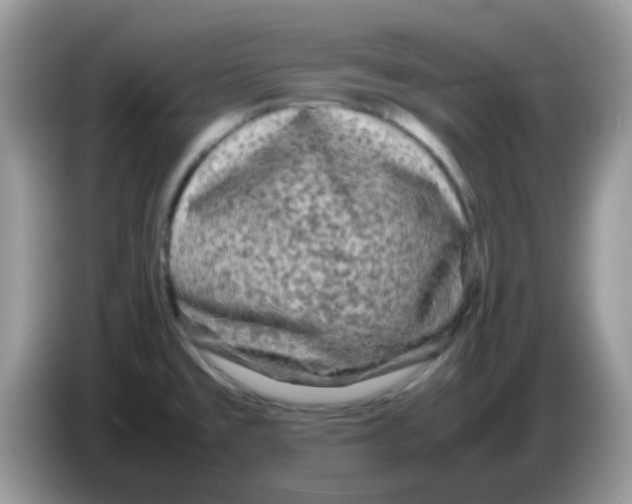 X0000086261477200704261946