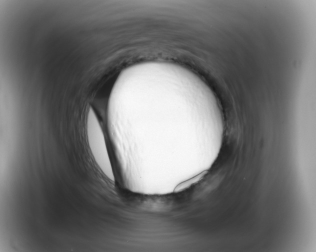 X0000086261490200704261945
