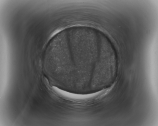 X0000086261505200704261945
