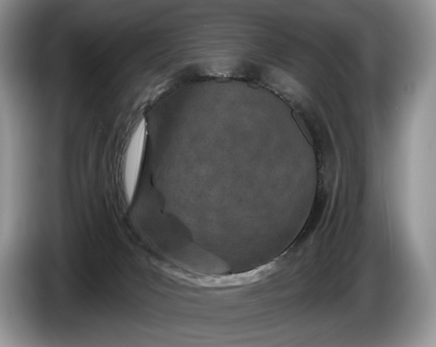 X0000086270031200704122037