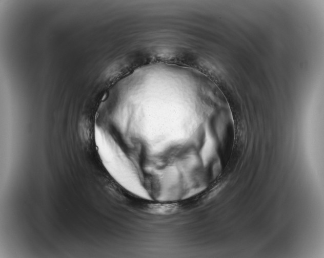 X0000086270135200704122036