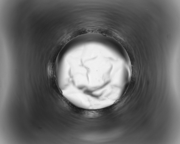 X0000086270287200704122035