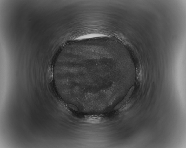 X0000086270471200704122032