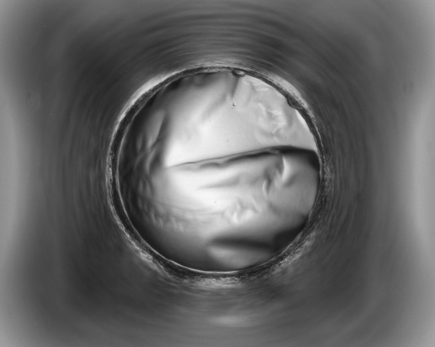 X0000086271133200704122024