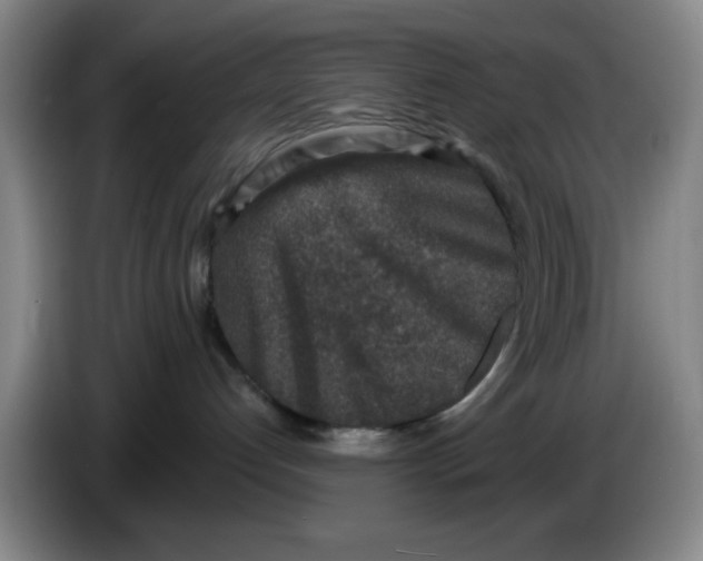 X0000086270192200704191933