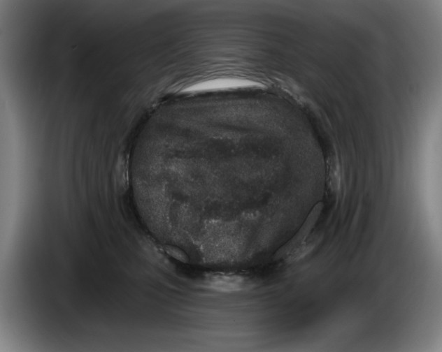 X0000086270471200704191928