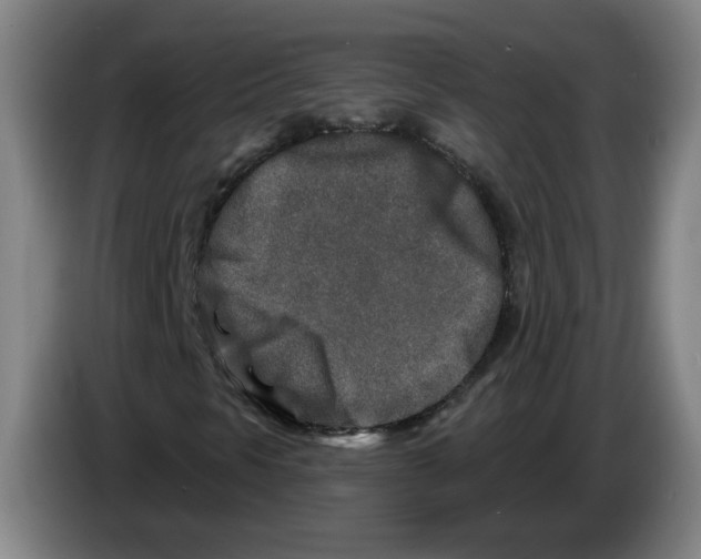 X0000086271297200704191916