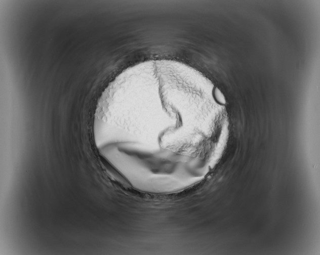 X0000086271393200704191915