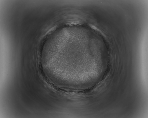 X0000086271399200704191915