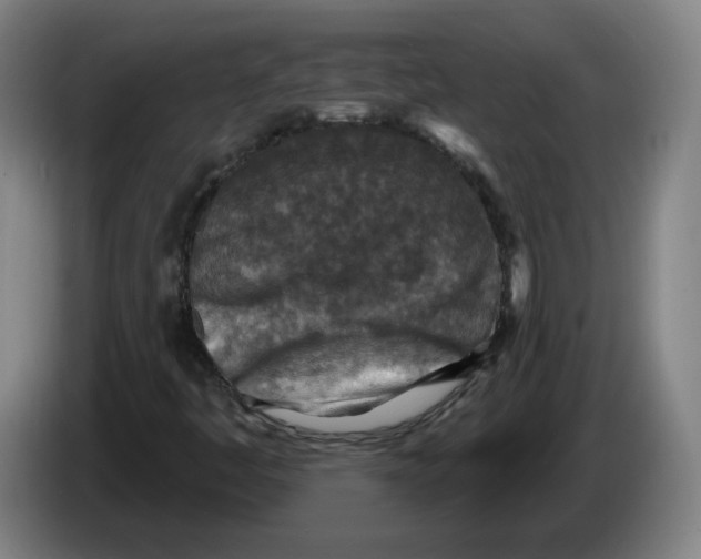 X0000086271445200704191915