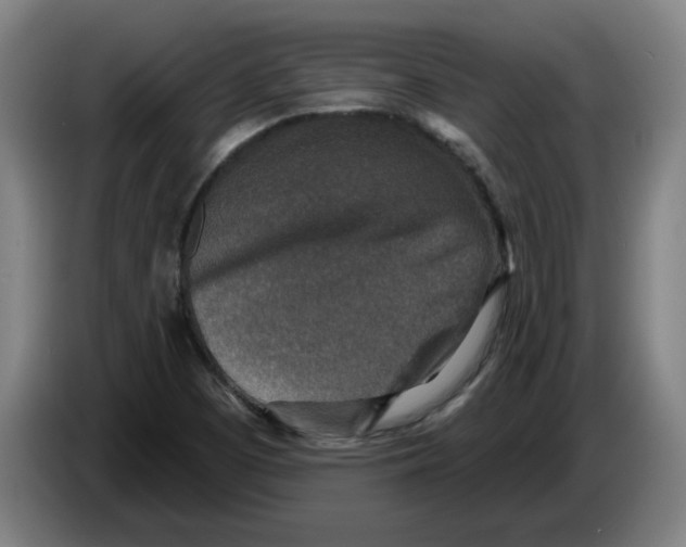 X0000086271457200704191914