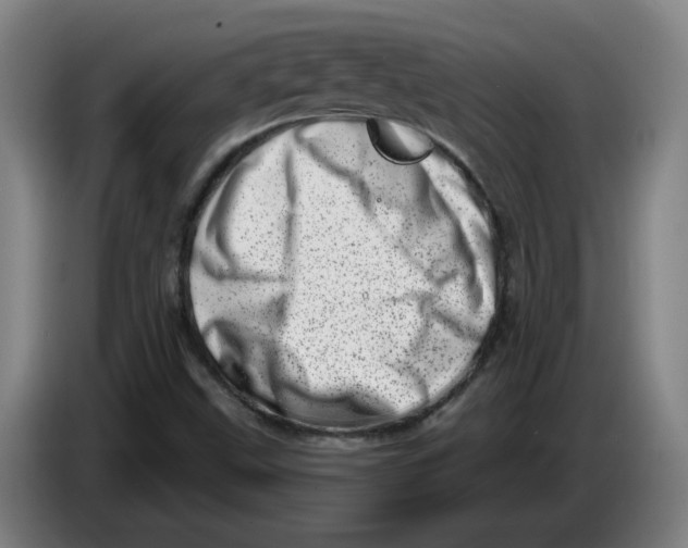 X0000086271499200704191914