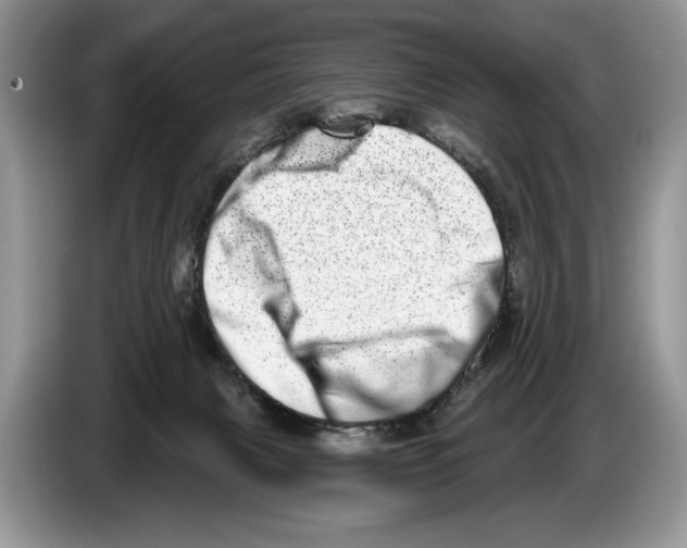 X0000086270079200704262025