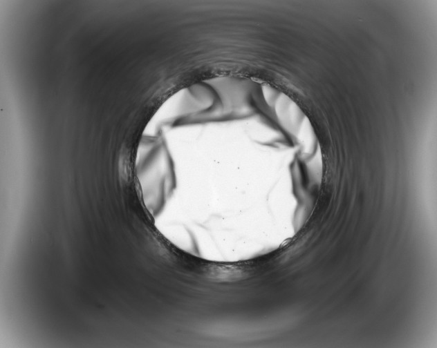 X0000086270287200704262022