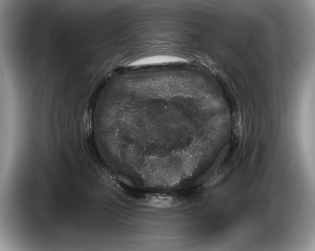 X0000086270471200704262020