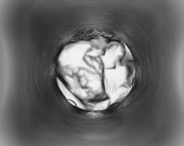 X0000086270477200704262020