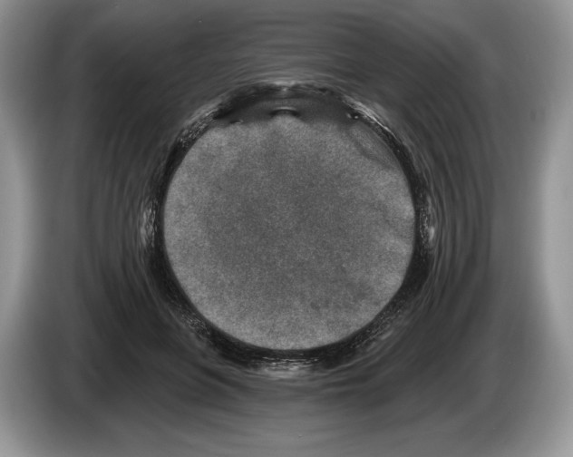 X0000086270551200704262018