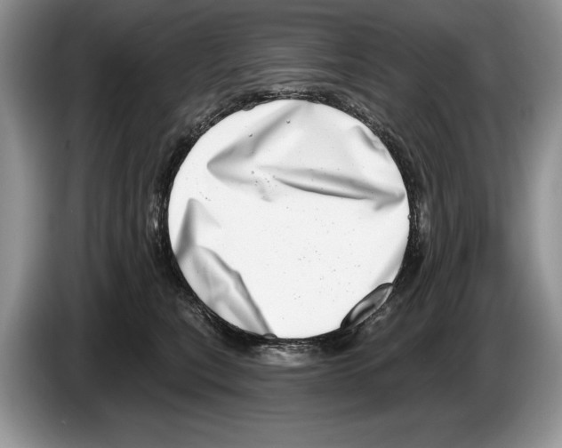 X0000086270567200704262018