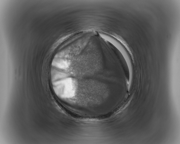 X0000086270577200704262018