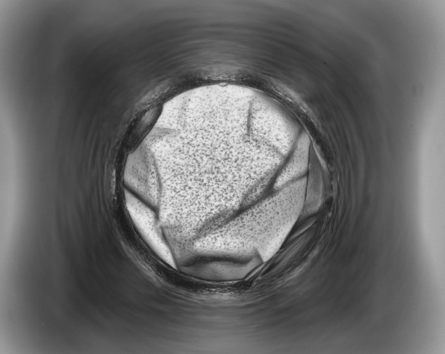 X0000086270589200704262018