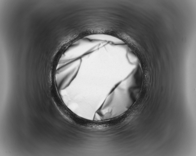 X0000086270638200704262017