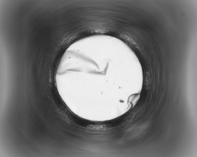 X0000086270639200704262017