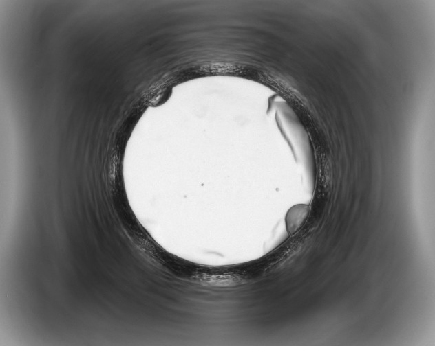 X0000086270645200704262017