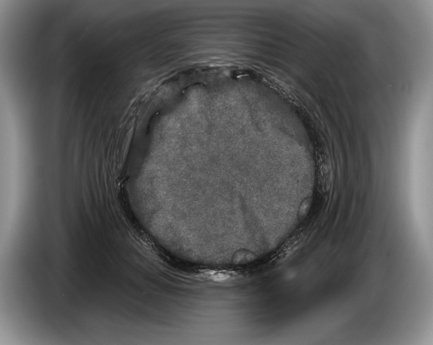 X0000086270654200704262017