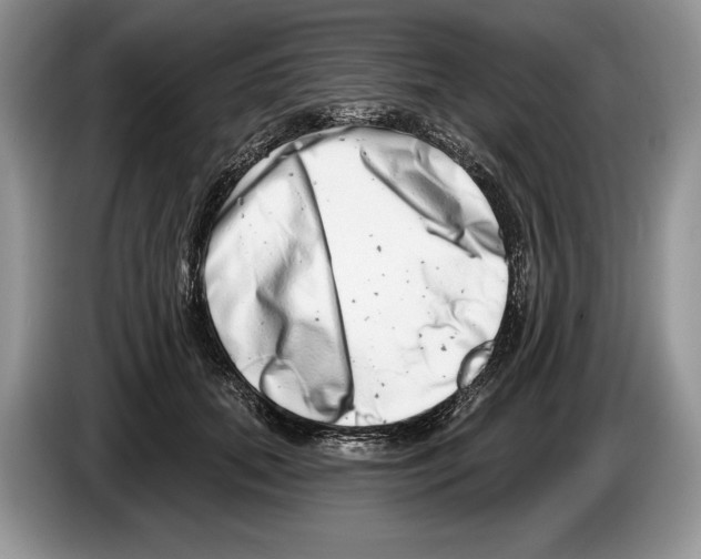 X0000086270655200704262017