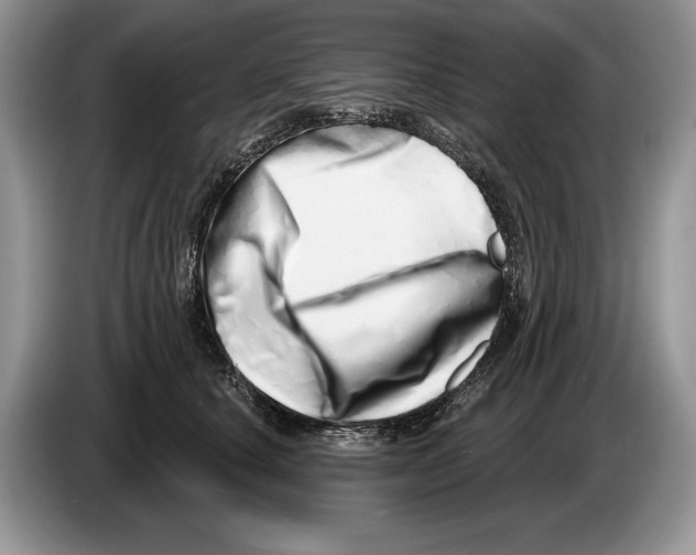 X0000086270660200704262017