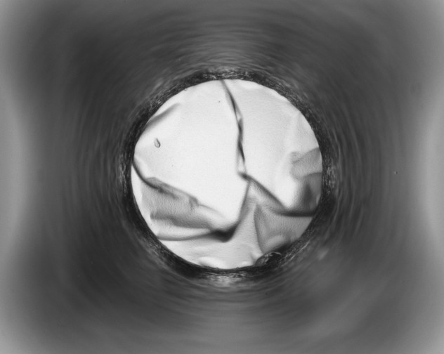 X0000086270662200704262017