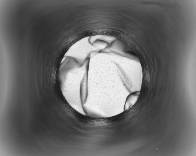 X0000086270668200704262017