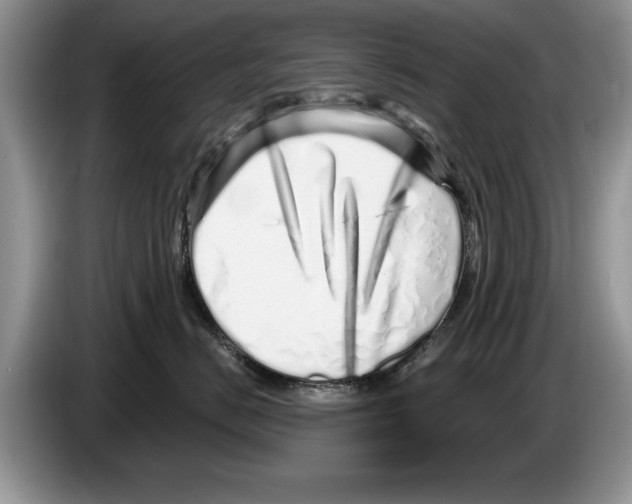 X0000086270670200704262017