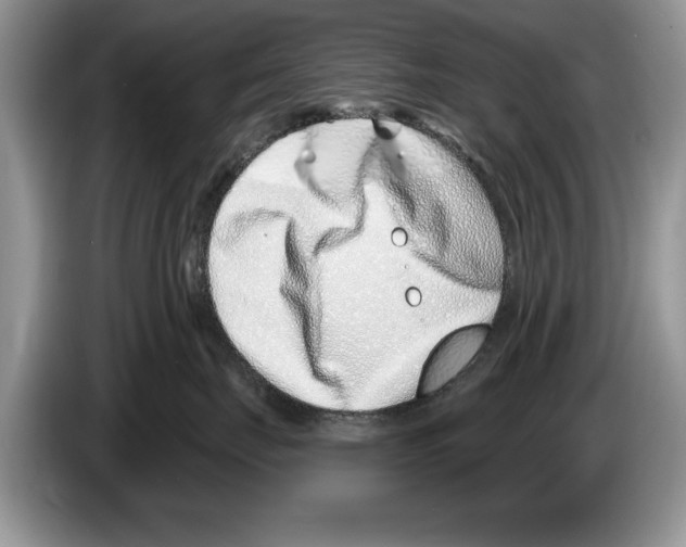X0000086270671200704262017