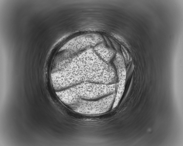X0000086270680200704262017