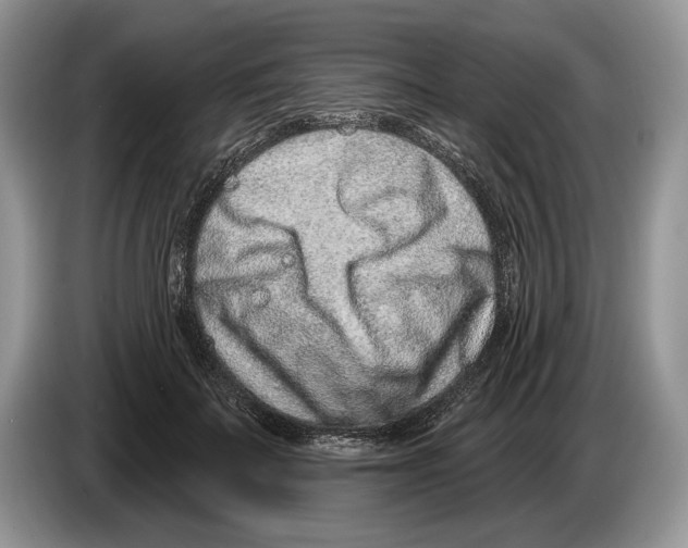 X0000086270699200704262016