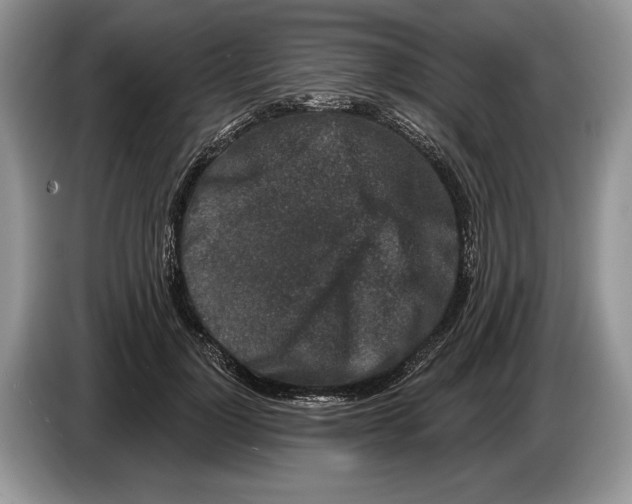 X0000086270748200704262016