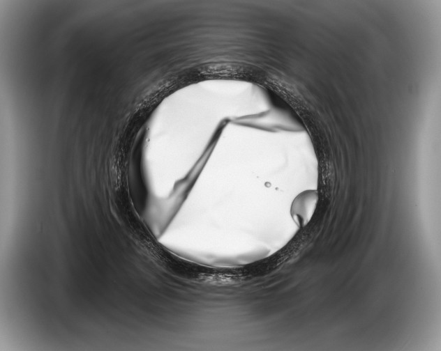 X0000086270751200704262016